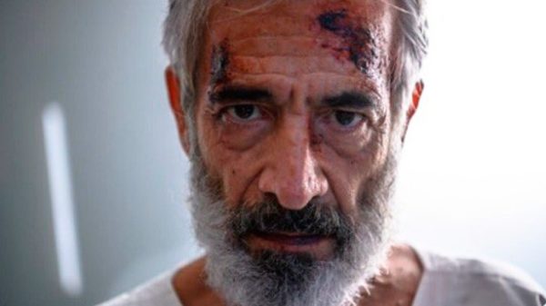 ¿Qué secuelas le quedan a Antonio? (Foto: RTVE)