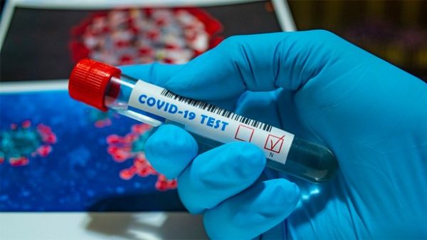 El SARS-CoV-2 tiene varias vías para producir afectación neurológica. (Foto: Pixabay)