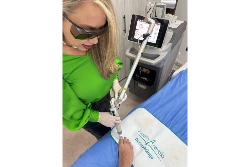Tecnología de avanzada en el tratamiento de onicomicosis, láser Q-Switched con la Dra. Janeth Arévalo