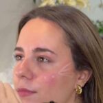 Innovaciones en tratamientos estéticos para 2025, hacia una belleza más natural y personalizada