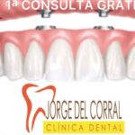 La solución definitiva en implantes dentales está en Clínica Dental Jorge del Corral