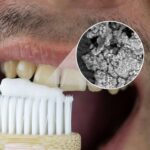 Firma dental murciana líder en blanqueamiento dental en casa