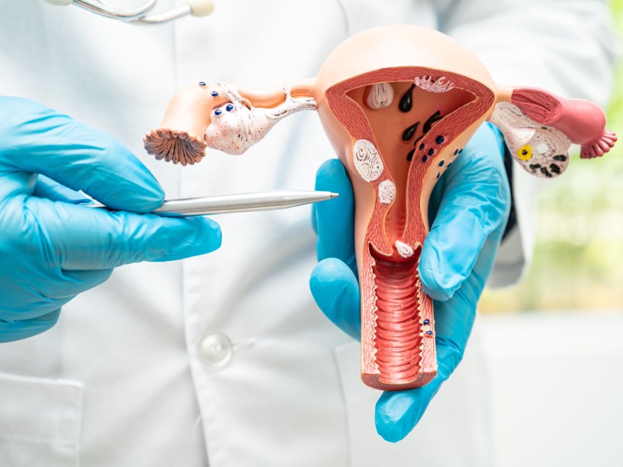 Dr. Juan Céspedes, ginecólogo de Policlínica Gipuzkoa: “La detección precoz del cáncer ginecológico permite tratamientos menos agresivos y mejora la supervivencia de las pacientes”