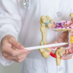 Dr. Juan Arenas, jefe del Servicio de Aparato Digestivo de Policlínica Gipuzkoa: “El aumento de casos de colitis ulcerosa y Crohn podría estar relacionado con la alimentación” Dr. Juan Arenas, jefe del Servicio de Aparato Digestivo de Policlínica Gipuzkoa: “El aumento de casos de colitis ulcerosa y Crohn podría estar relacionado con la alimentación”