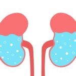 Hidronefrosis en niños; qué es y cómo afecta a su salud