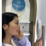 Efecto purga de la piel; qué es y cómo diferenciarlo del acné