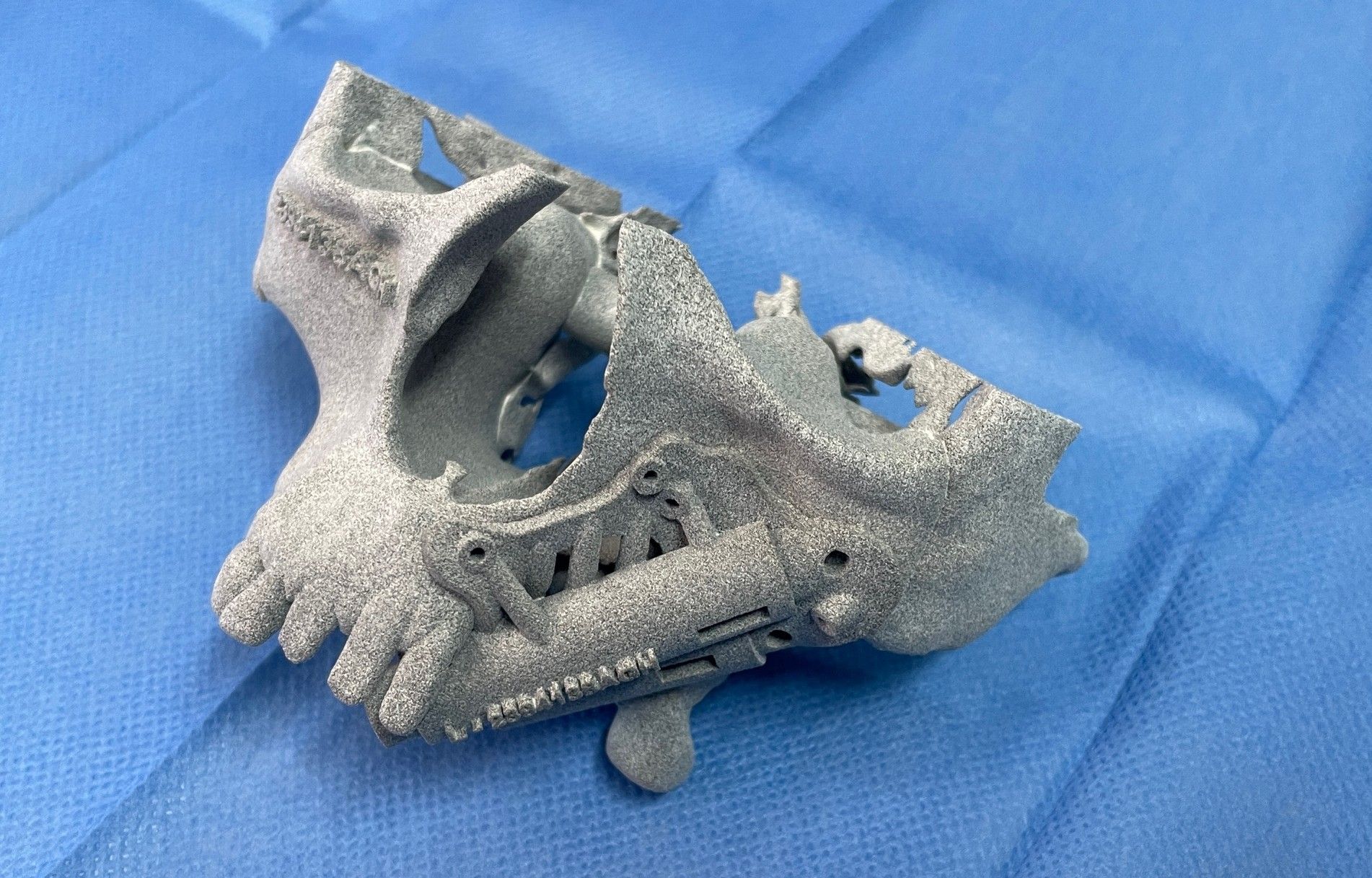 Los implantes cigomáticos mediante cirugía guiada son una solución segura para la rehabilitación de maxilares atróficos o secuelas de tumores Los implantes cigomáticos mediante cirugía guiada son una solución segura para la rehabilitación de maxilares atróficos o secuelas de tumores