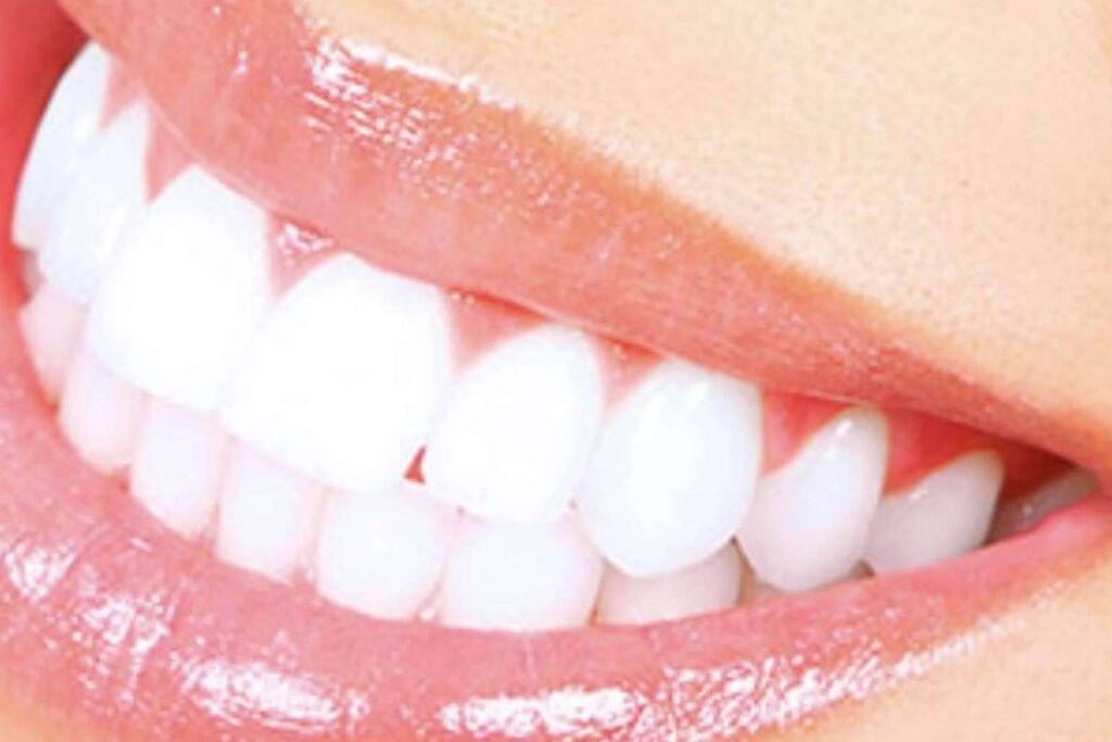 Prótesis fija estética de zirconio; la apuesta de Clínica Dental Jorge del Corral por la calidad y la estética dental