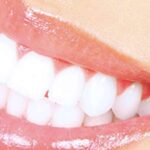 Prótesis fija estética de zirconio; la apuesta de Clínica Dental Jorge del Corral por la calidad y la estética dental