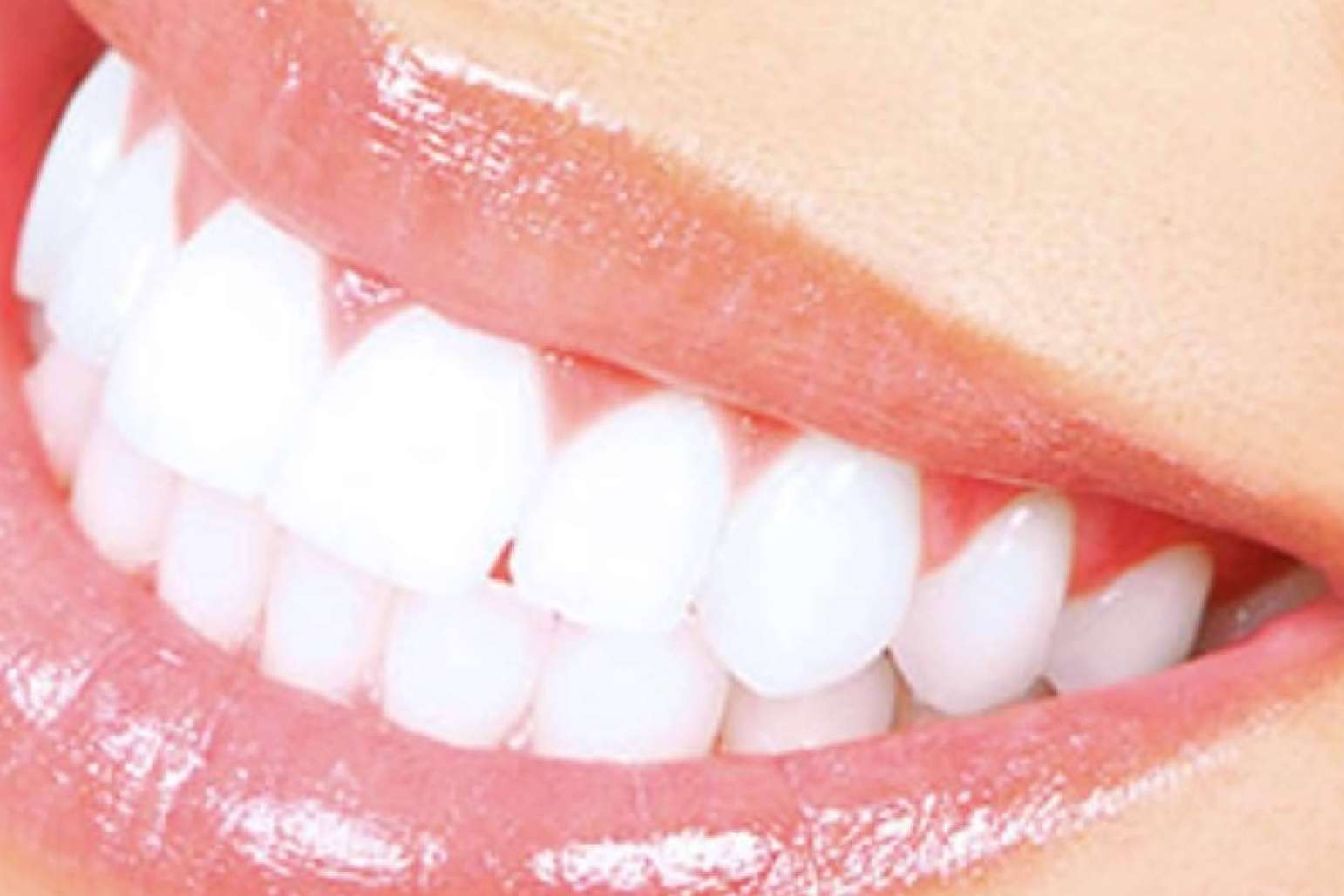 Prótesis fija estética de zirconio; la apuesta de Clínica Dental Jorge del Corral por la calidad y la estética dental