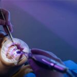 La clínica Denty Dent destaca por sus tratamientos dentales de alta calidad a precios asequibles en Madrid