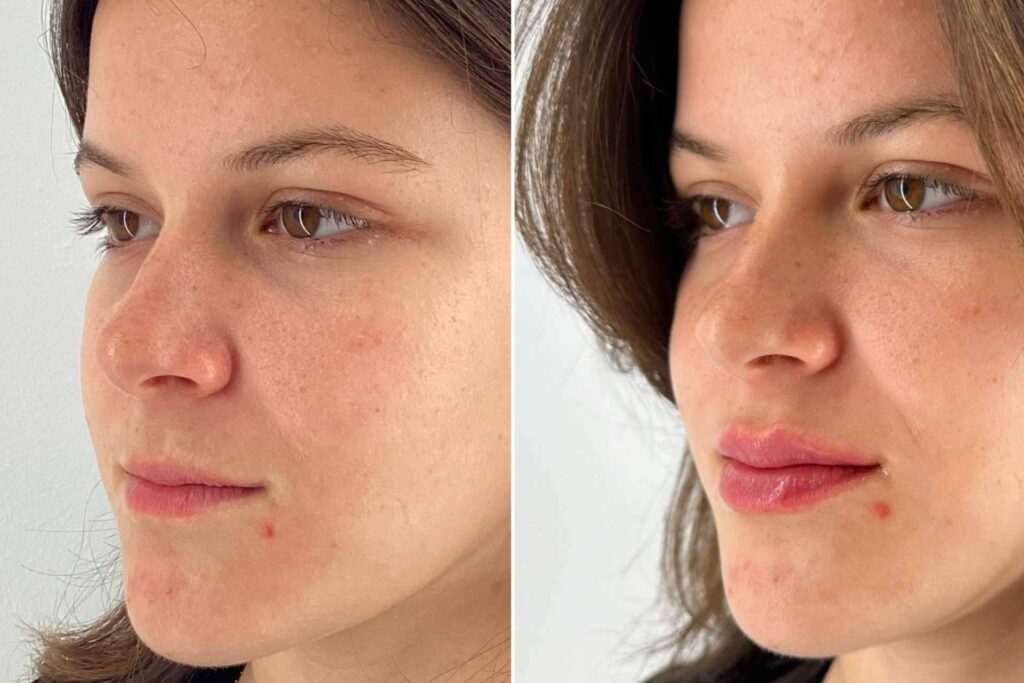Holaglow presenta Glow Lips, la técnica que redefine el concepto de ‘ponerse boca’