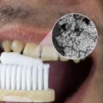 La revolución en el cuidado dental; Una pasta de dientes que regenera el esmalte y elimina manchas