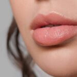 Centro Estetica el Pilar eleva la estética labial con ácido hialurónico de última generación