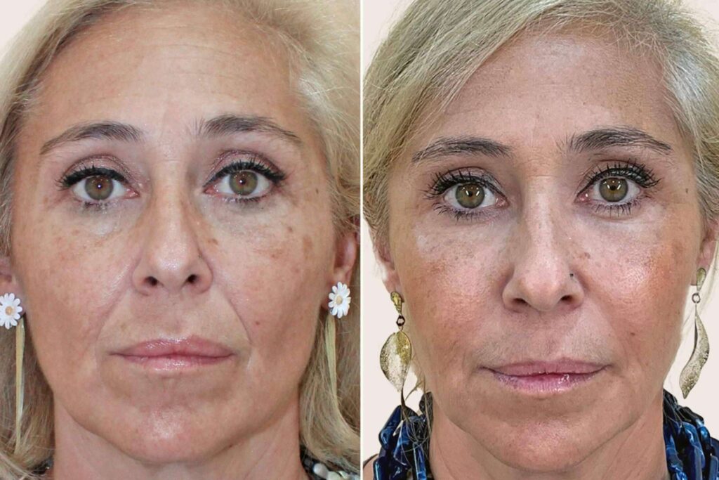 Más allá de los inductores; la clave para unos rasgos más armónicos a cualquier edad