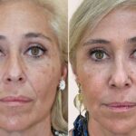 Más allá de los inductores; la clave para unos rasgos más armónicos a cualquier edad