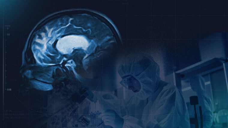 GEN y Sulfateq anuncian resultados positivos en fase 1 del fármaco SUL-238 para el Alzheimer