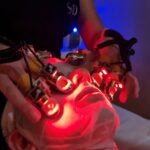 Una pérdida de peso rápida podría afectar a la piel del rostro, así lo explica la fundadora de los Centros de Estética Marquessa Una pérdida de peso rápida podría afectar a la piel del rostro, así lo explica la fundadora de los Centros de Estética Marquessa
