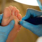 Los podólogos de la Unidad del Pie de Policlínica Gipuzkoa y Podoactiva ofrecen consejos para tratar el aumento de infecciones por hongos en los pies durante el verano Los podólogos de la Unidad del Pie de Policlínica Gipuzkoa y Podoactiva ofrecen consejos para tratar el aumento de infecciones por hongos en los pies durante el verano