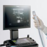 Sonosite LX introduce la ultra-alta frecuencia en POCUS con el primer y único transductor de 46 MHz
