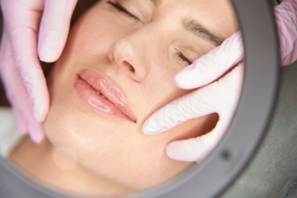 Clínica Ibiza explica qué es el lip lift o cirugía de labios, y para quién se pauta