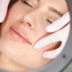 Clínica Ibiza explica qué es el lip lift o cirugía de labios, y para quién se pauta