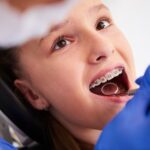 Clínica Ponce centra su actividad en ortodoncia infantil en la detección temprana de alteraciones dentales
